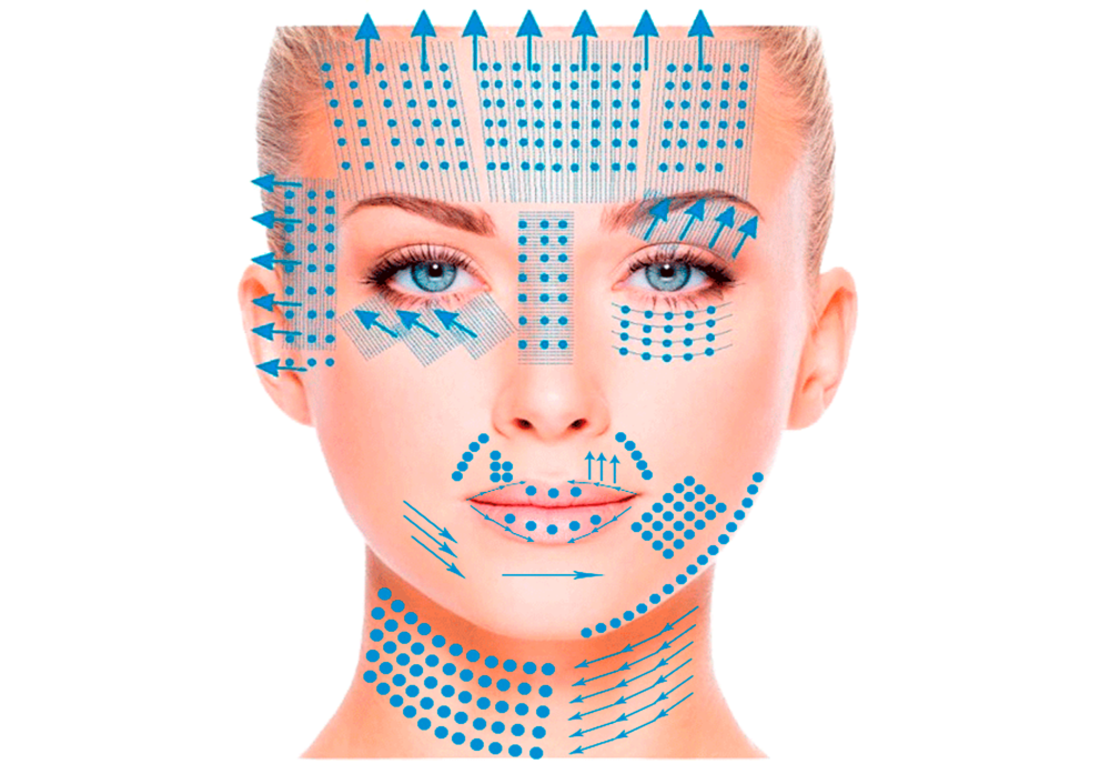 Техники введения мезопрепаратов