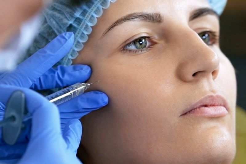 Коррекция скул филлерами