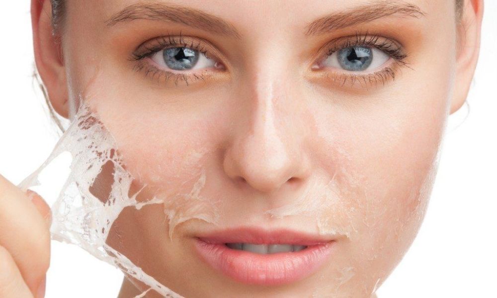 Гликолевый пилинг