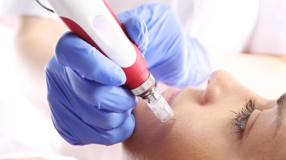 Что такое фракционная мезотерапия?