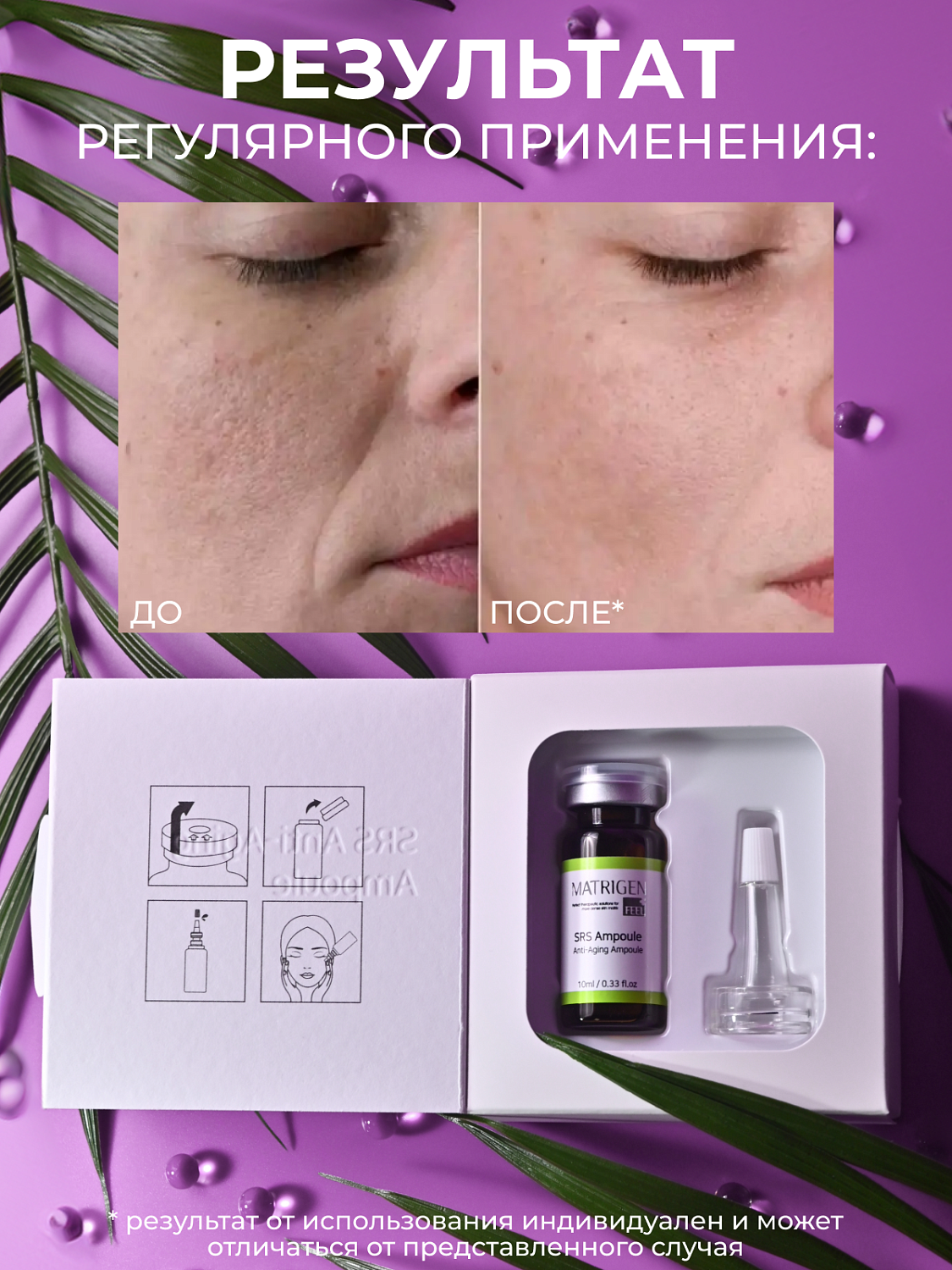 Matrigen SRS Anti-aging Ampoule Сыворотка для лица антивозрастная, 10 мл