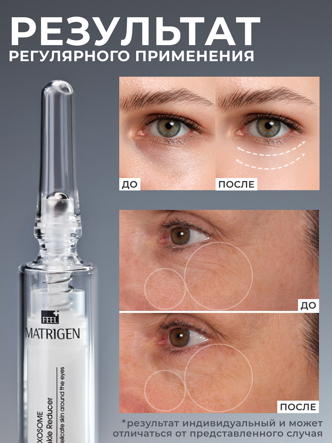 Matrigen Lipo Exosome Gratify Furrow Complex Крем для кожи вокруг глаз с роликовым массажёром, 10 мл