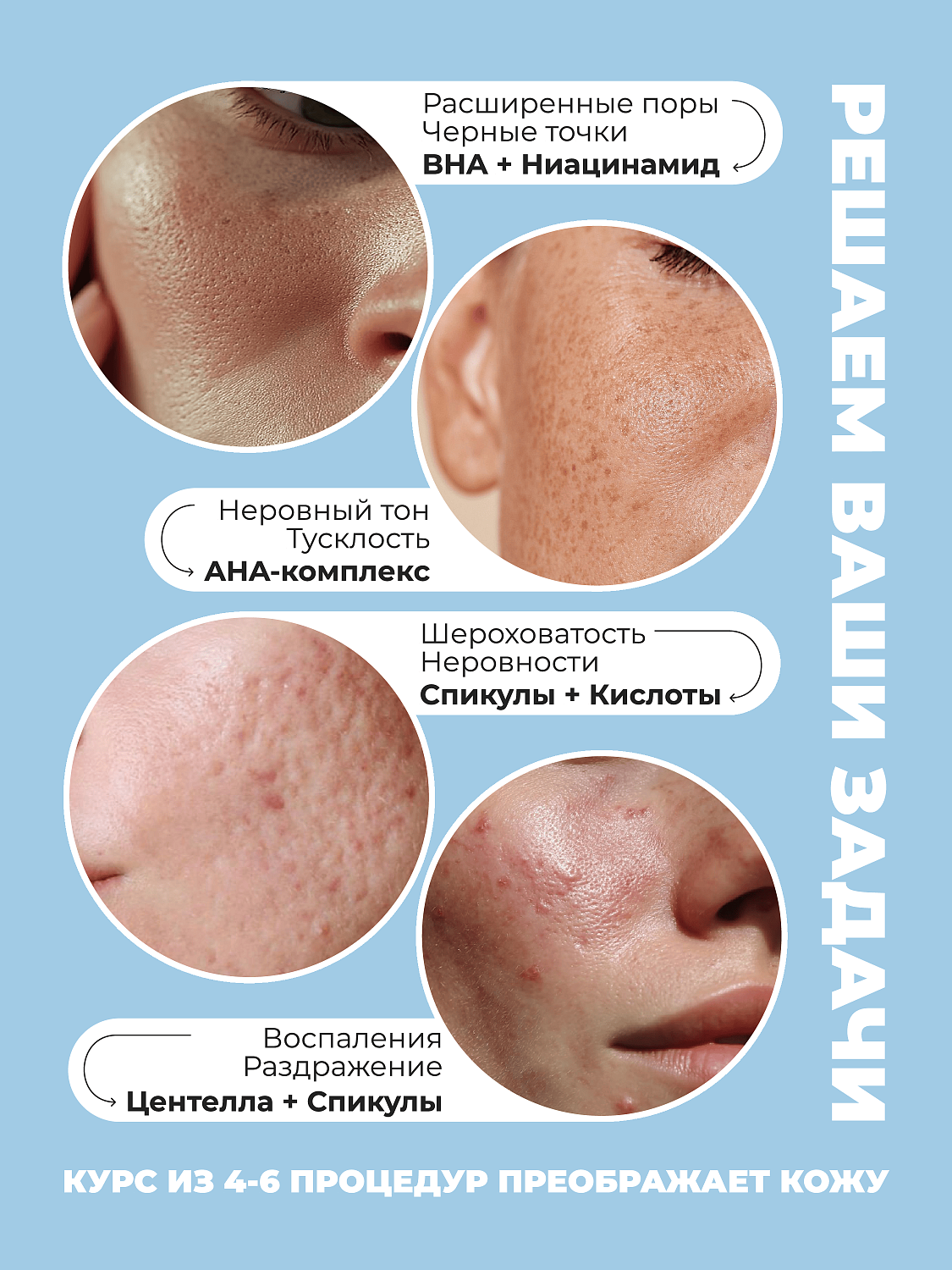 Desembre 3in1 Peeling Cream Крем для лица пилинг 3 в 1 отшелушивающий обновляющий, 5 г х 1 шт