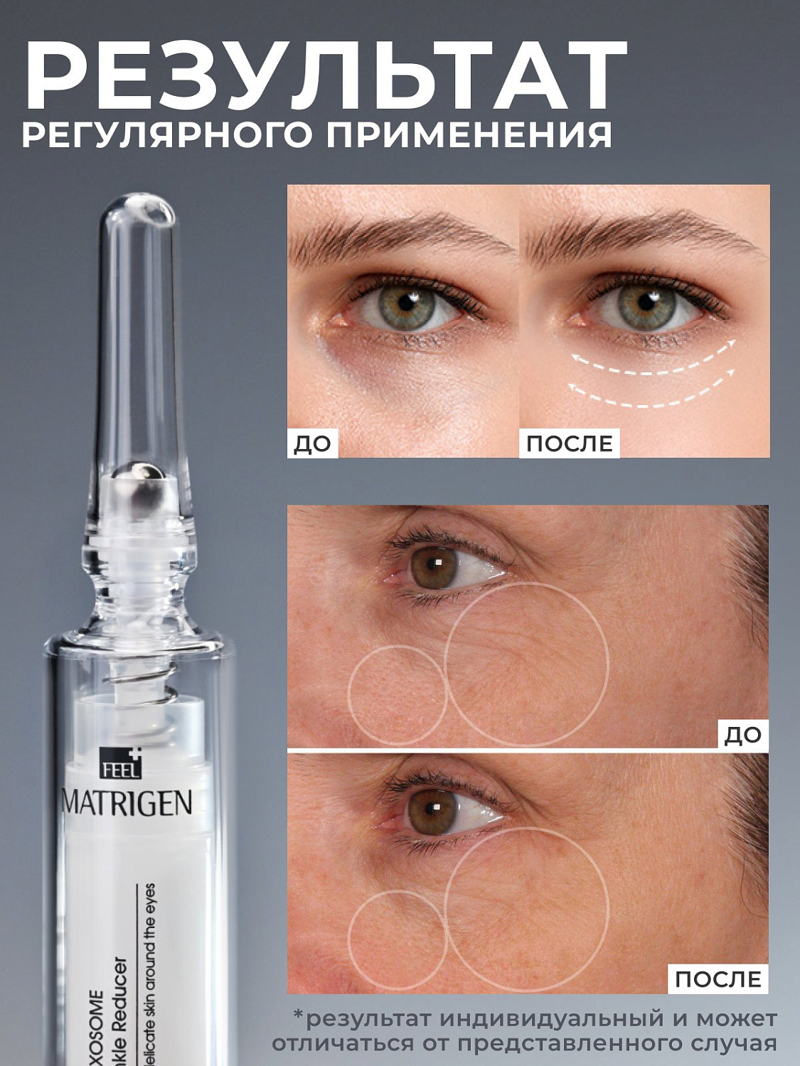Matrigen Lipo Exosome Gratify Furrow Complex 10ml