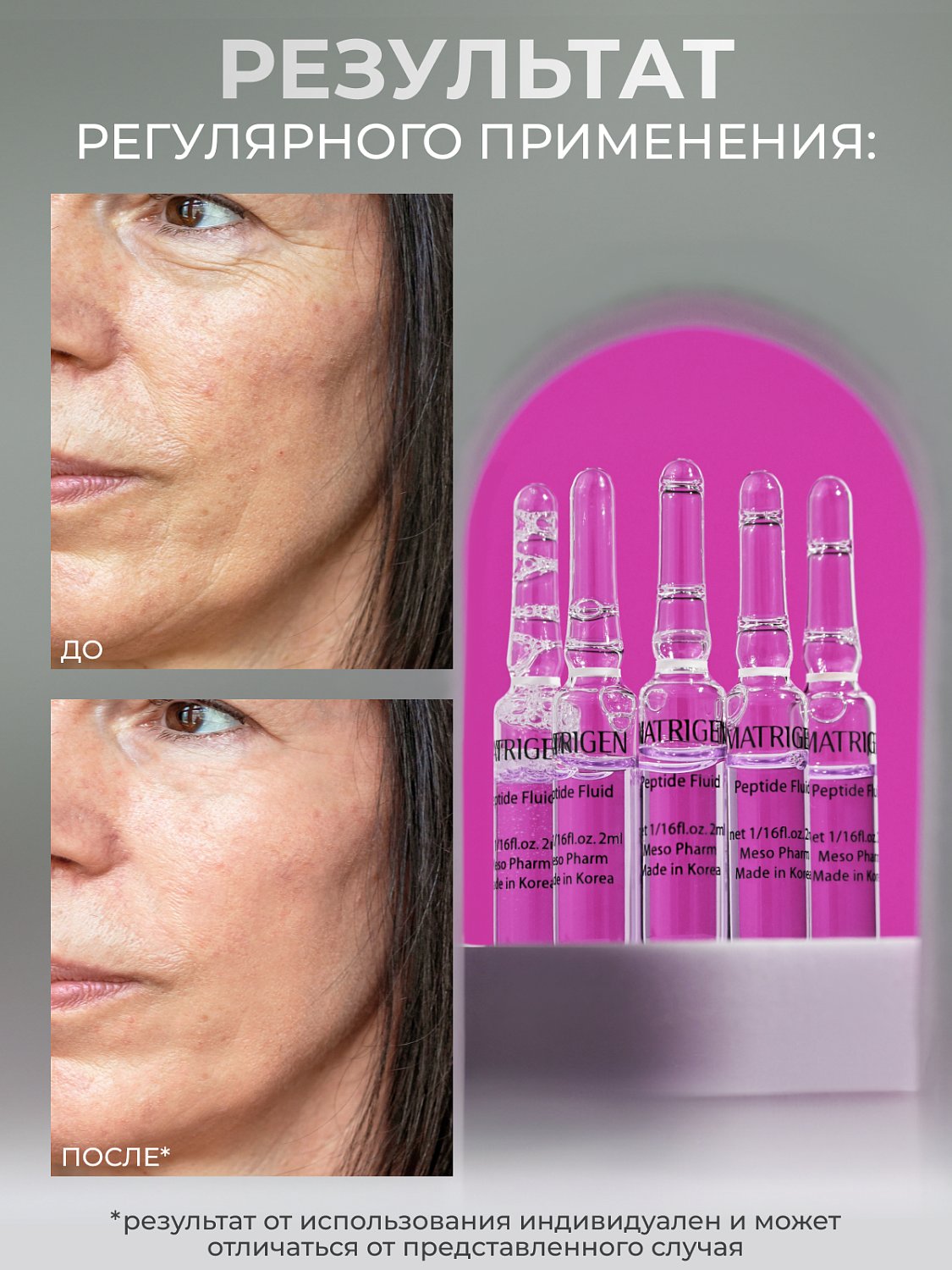Matrigen Peptide Fluids Сыворотка - флюид для лица с пептидами, 2 мл х 5 шт