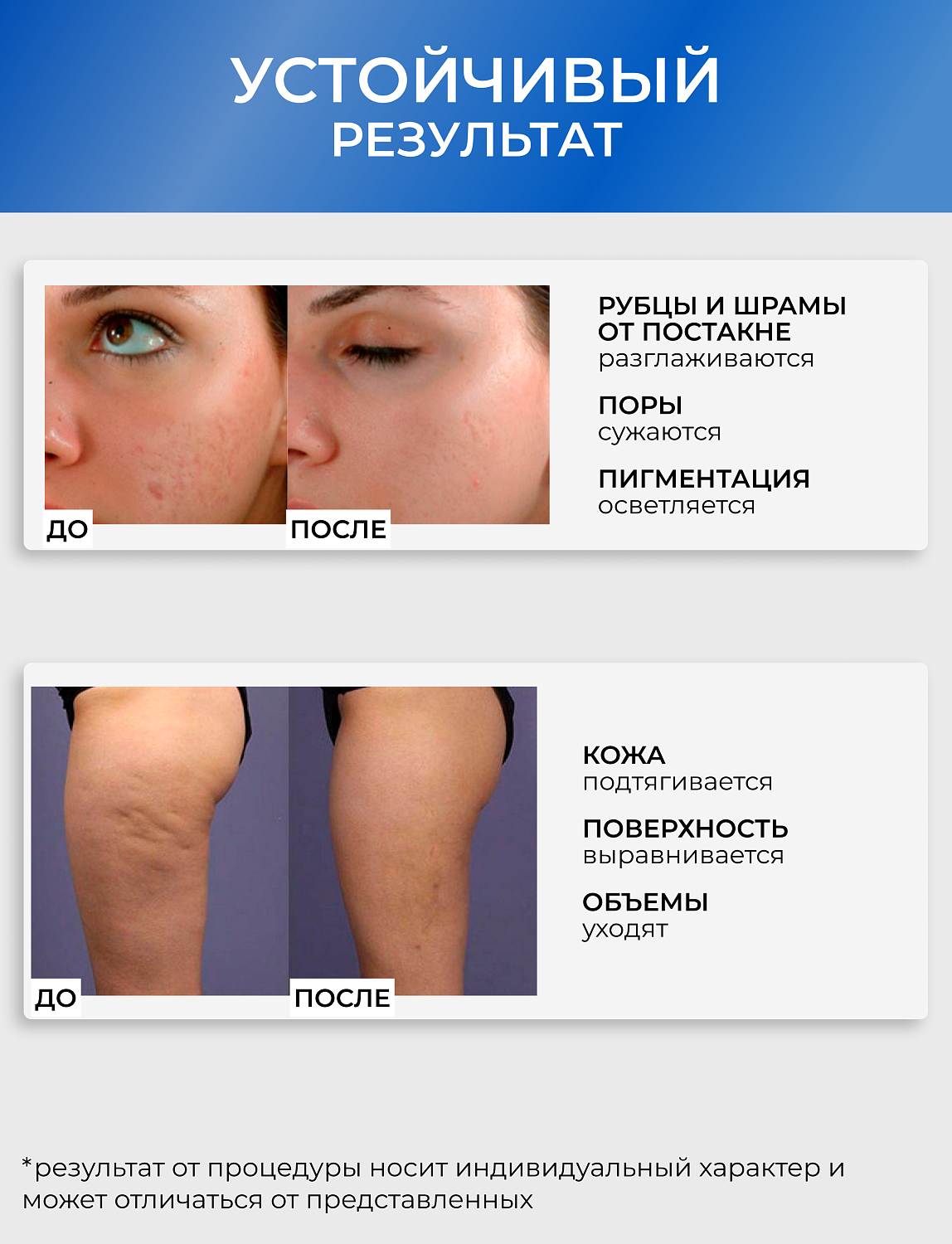 Dr.pen A6 Аппарат для фракционного микроштампинга / электрический массажер для лица / дермапен ULTIMA - A6