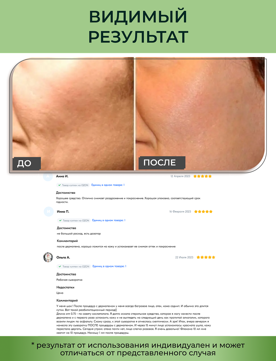 Matrigen SRS Calming Ampoule Сыворотка для лица успокаивающая, 10 мл