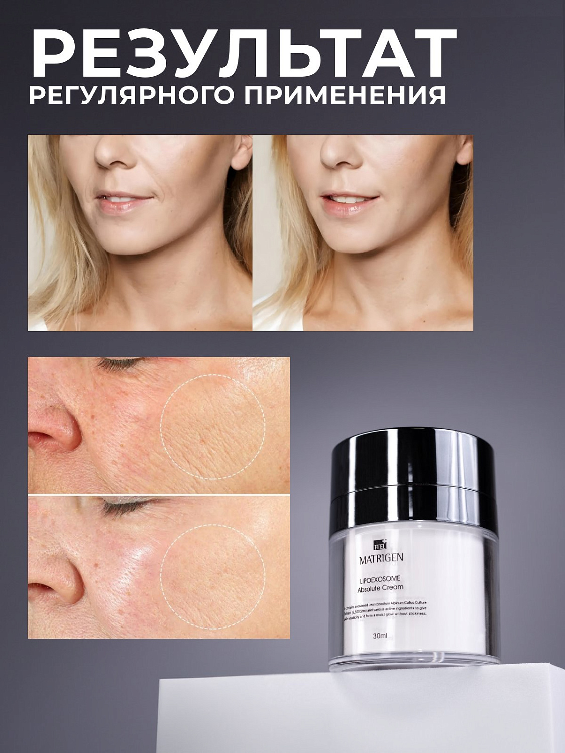 Matrigen Lipo Exosome Absolute Cream 30ml