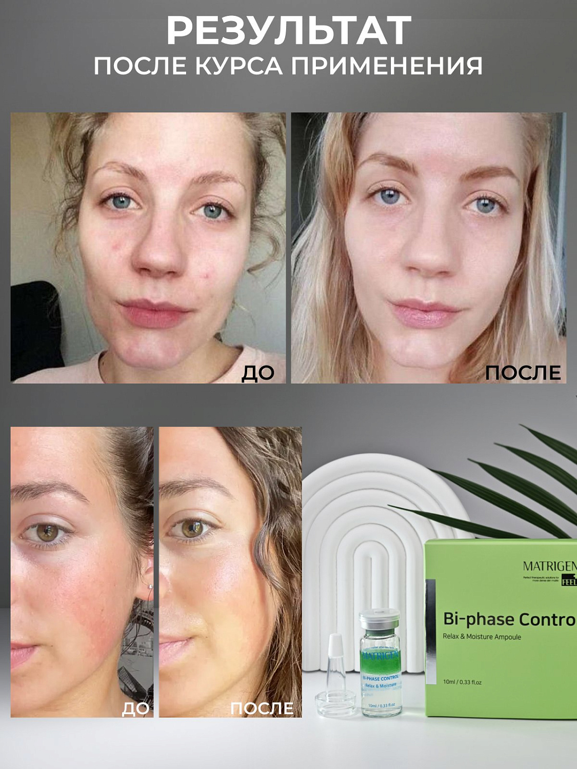 Matrigen Biphase Control Relax & Moisture Антистресс Увлажнение сыворотка для лица 1 шт 
