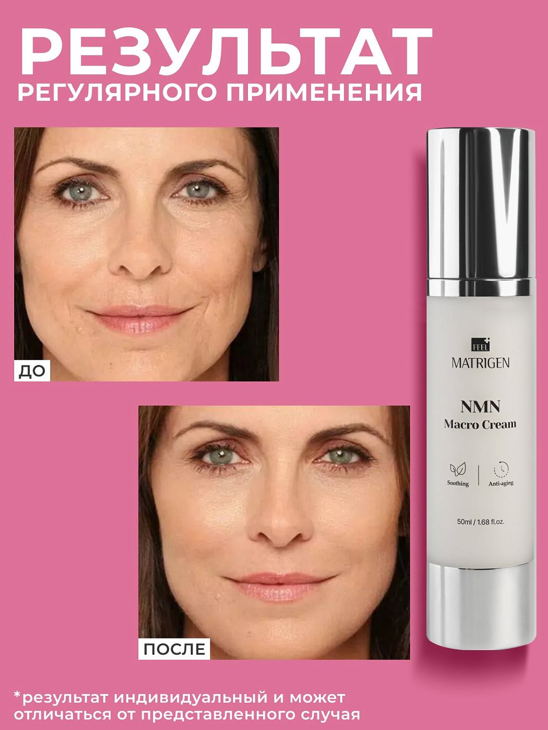 Matrigen NMN Macro Cream 50ml