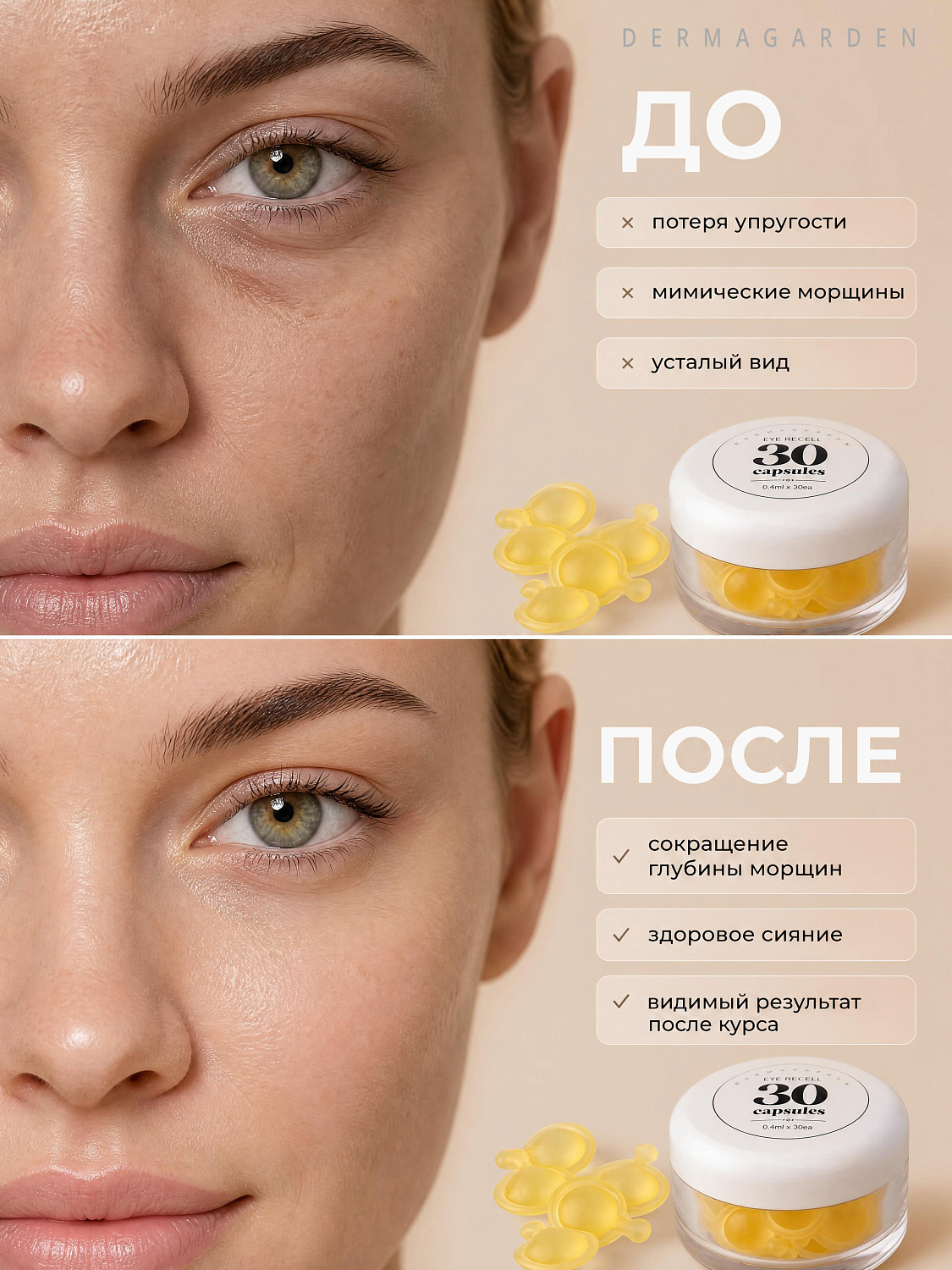 Dermagarden Eye Recell Capsule Восстанавливающая сыворотка для кожи вокруг глаз, 0.4 мл х 30 капсул