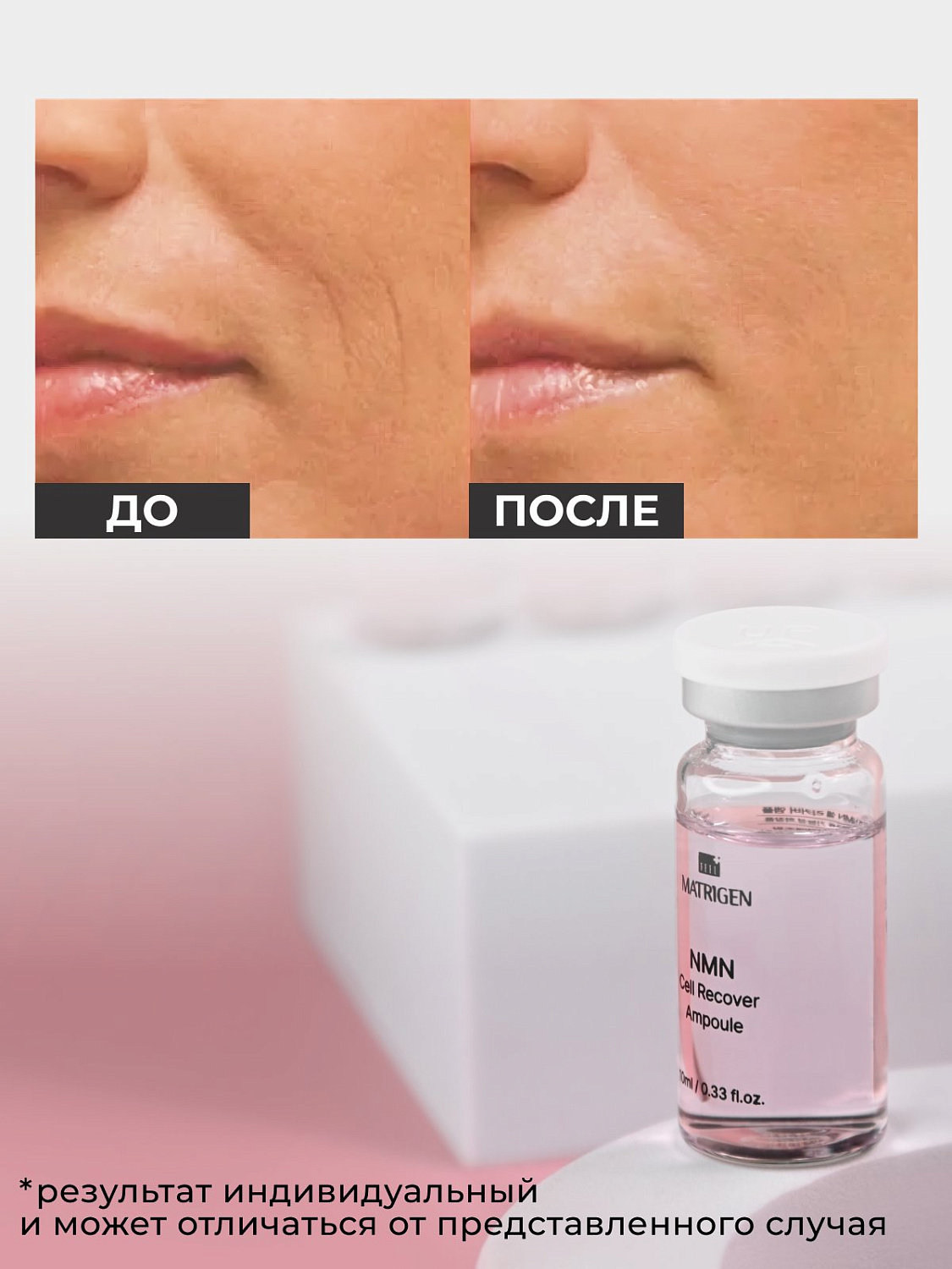 Matrigen NMN Cell Recover Ampoule 10ml*5Ea