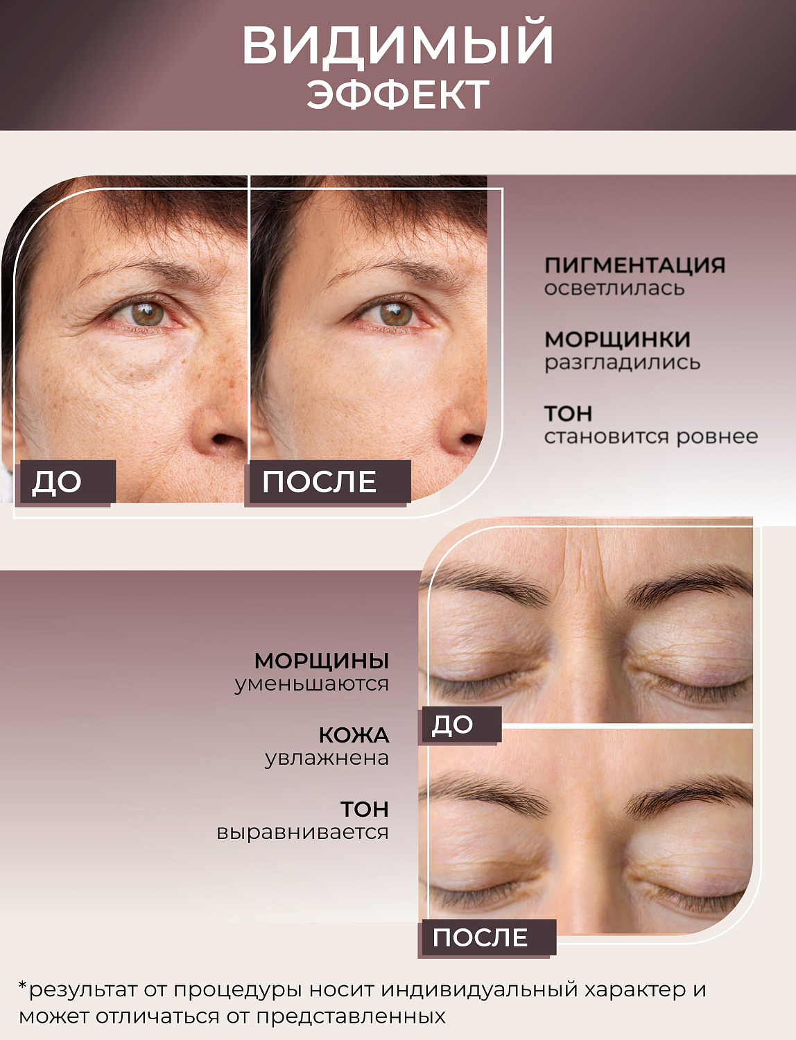 Dr.pen A10 Аппарат для фракционного микроштампинга / электрический массажер для лица / дермапен а10