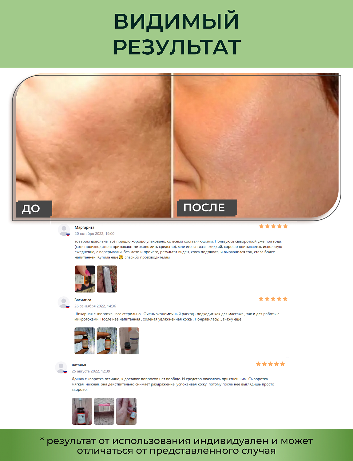 Matrigen SRS Calming Ampoule Сыворотка для лица успокаивающая, 10 мл