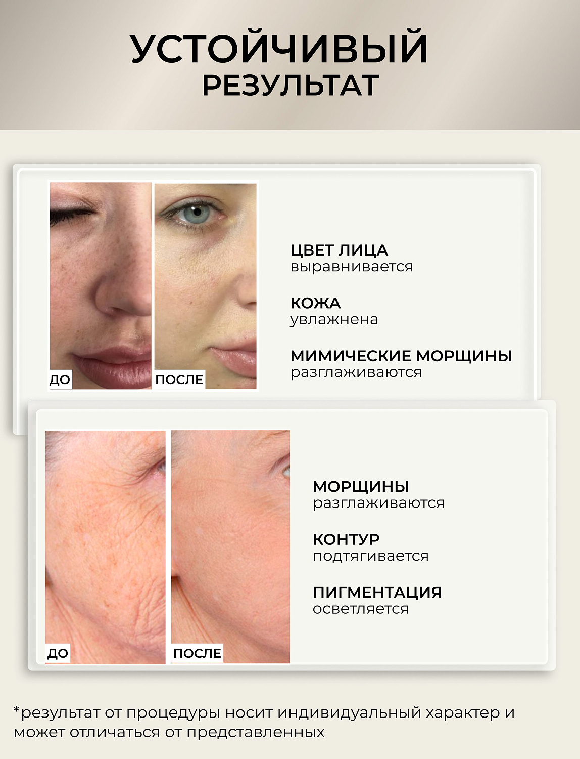 Dr.pen Е30 Аппарат для фракционного микроштампинга / электрический массажер для лица / дермапен Ultima E30 - W